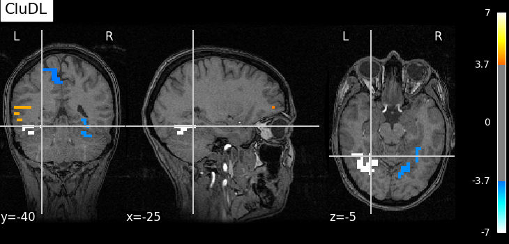 plot fmri data example