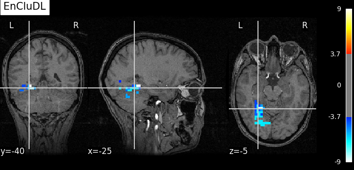 plot fmri data example