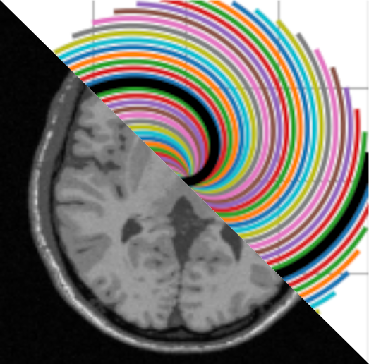 MRI acquisition and Reconstruction - Home