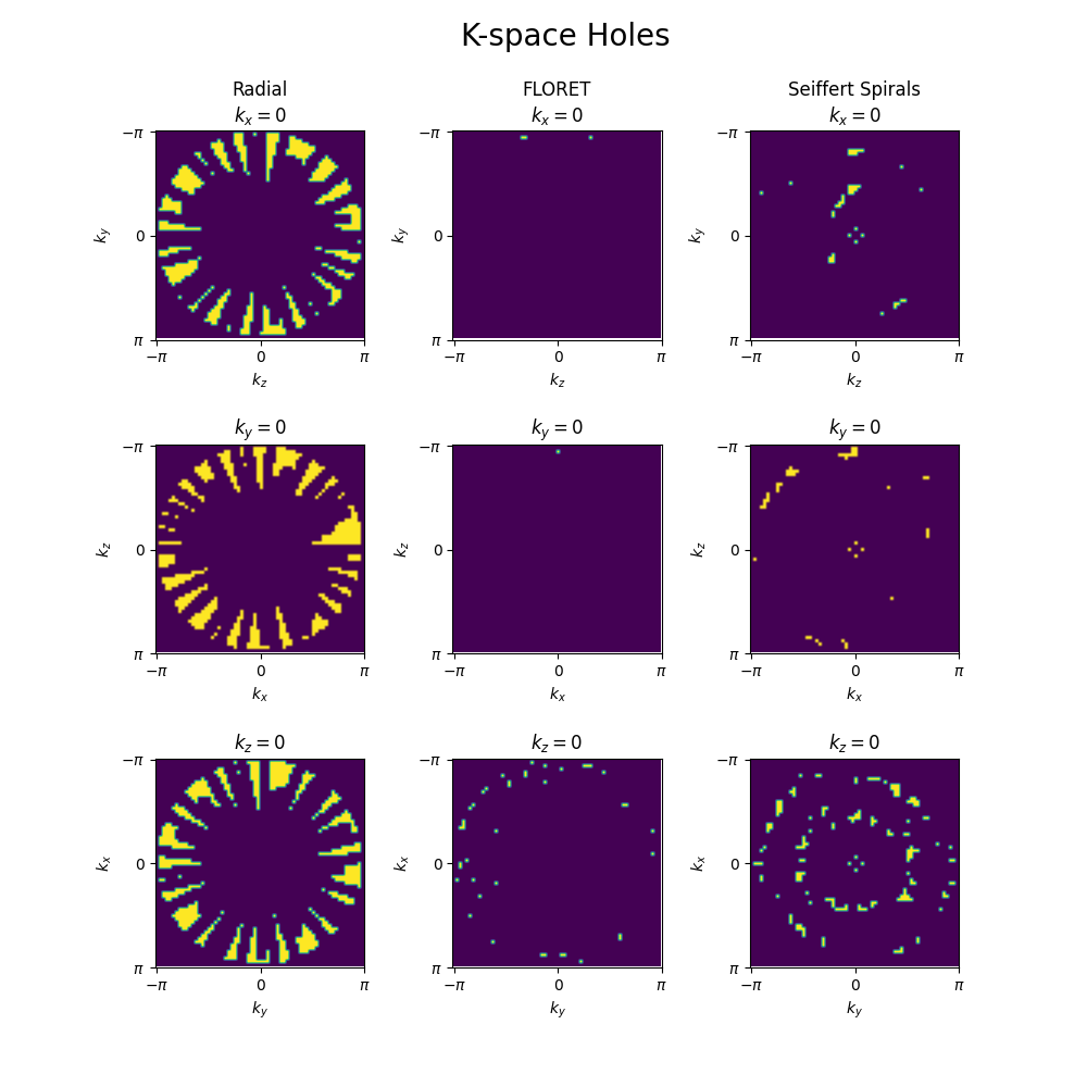 K-space Holes, Radial $k_{x}=0$, FLORET $k_{x}=0$, Seiffert Spirals $k_{x}=0$, $k_{y}=0$, $k_{y}=0$, $k_{y}=0$, $k_{z}=0$, $k_{z}=0$, $k_{z}=0$