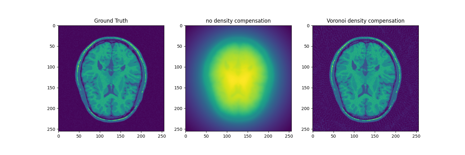 Ground Truth, no density compensation, Voronoi density compensation