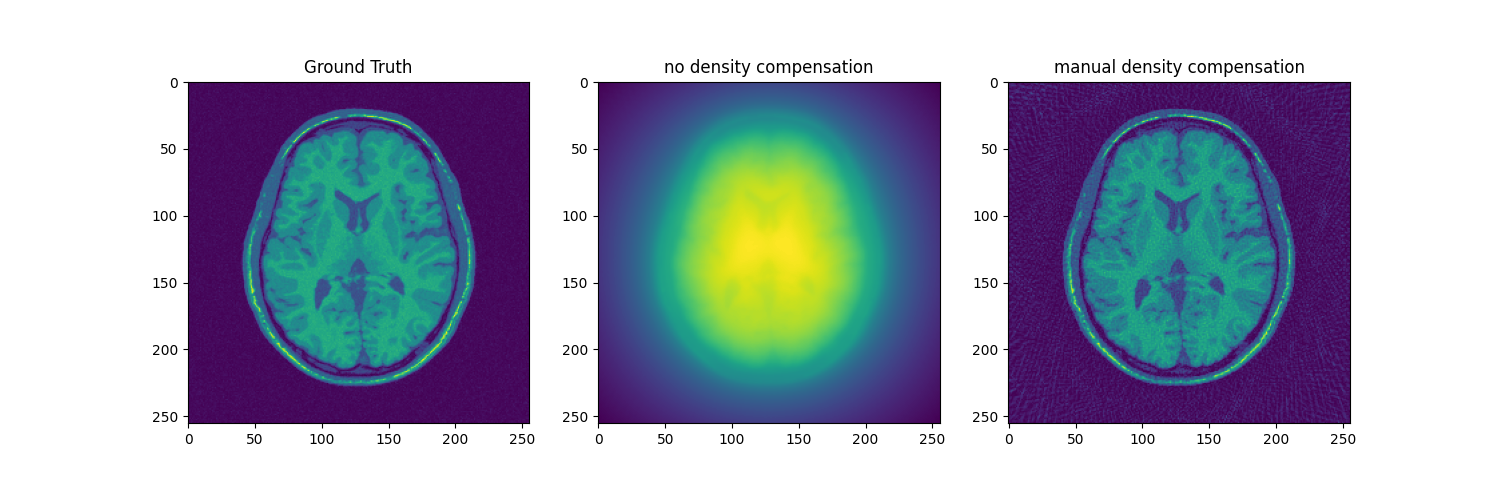 Ground Truth, no density compensation, manual density compensation