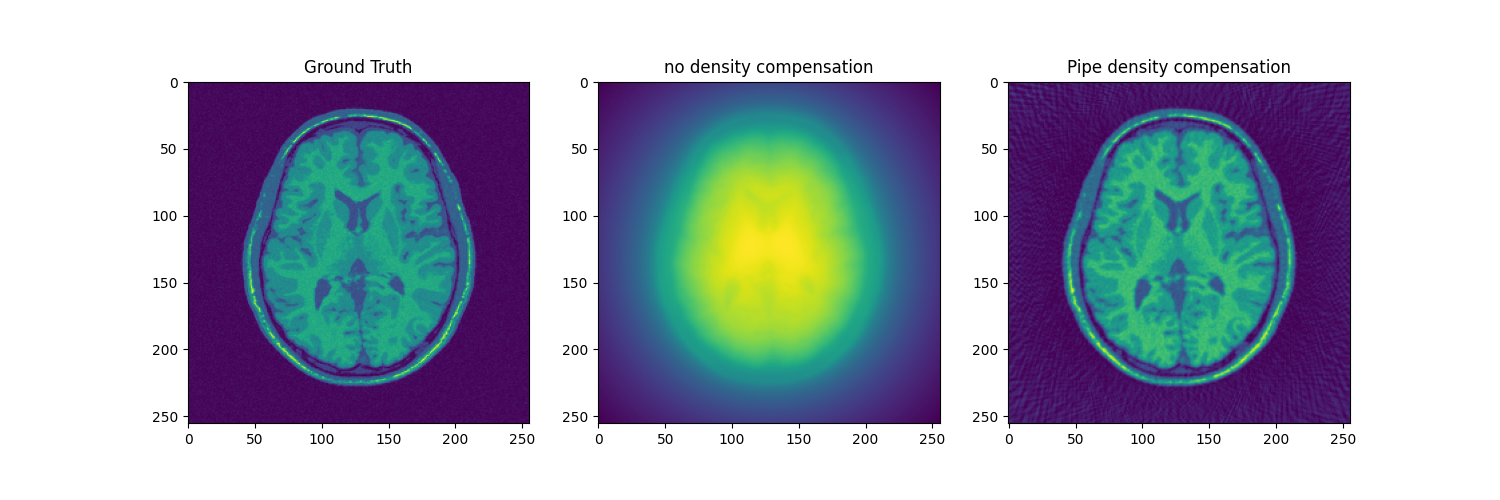 Ground Truth, no density compensation, Pipe density compensation