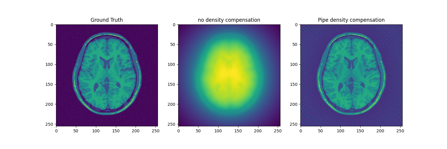 Ground Truth, no density compensation, Pipe density compensation
