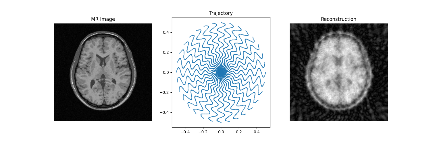 MR Image, Trajectory, Reconstruction