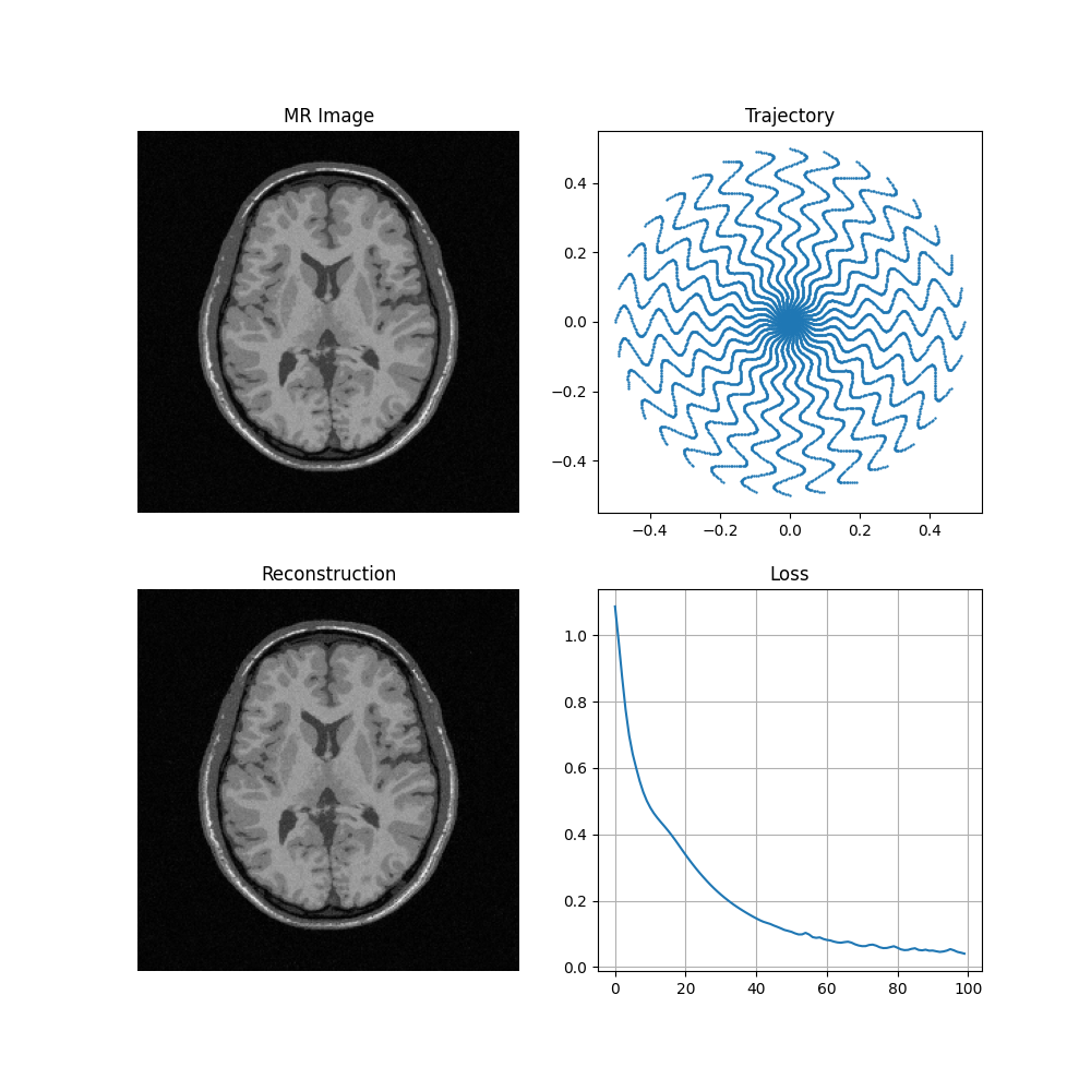 MR Image, Trajectory, Reconstruction, Loss