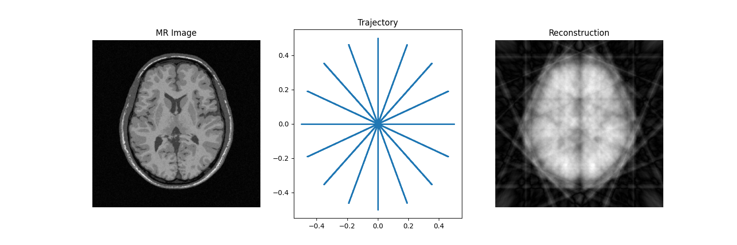 MR Image, Trajectory, Reconstruction