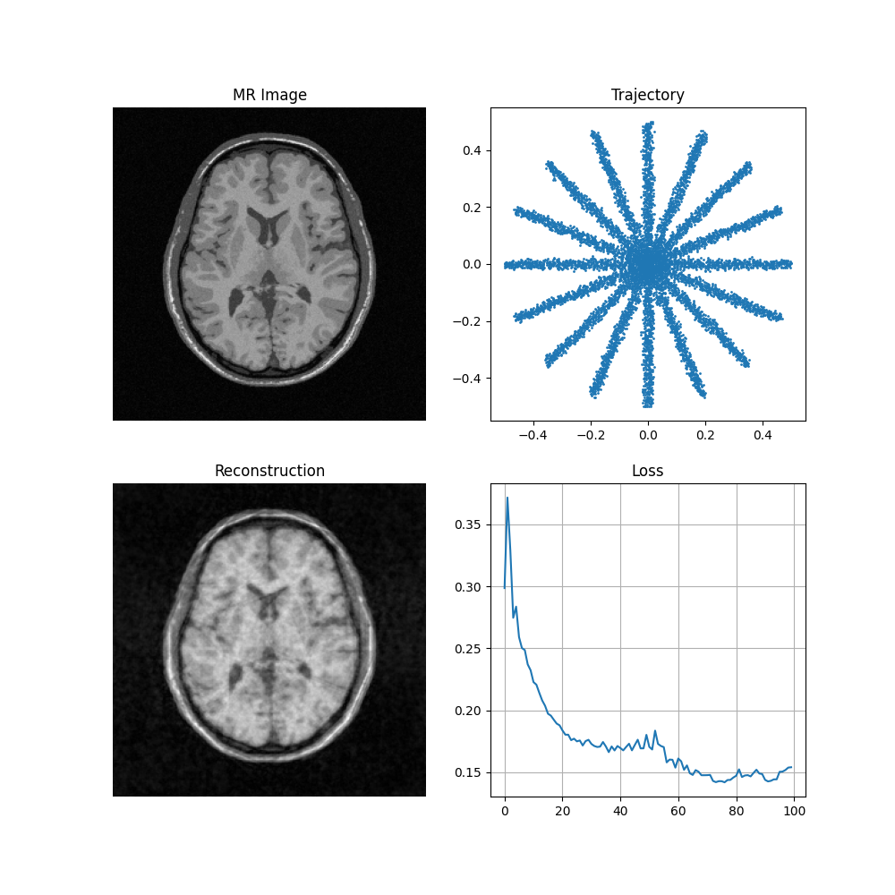 MR Image, Trajectory, Reconstruction, Loss