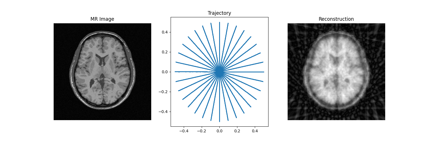 MR Image, Trajectory, Reconstruction