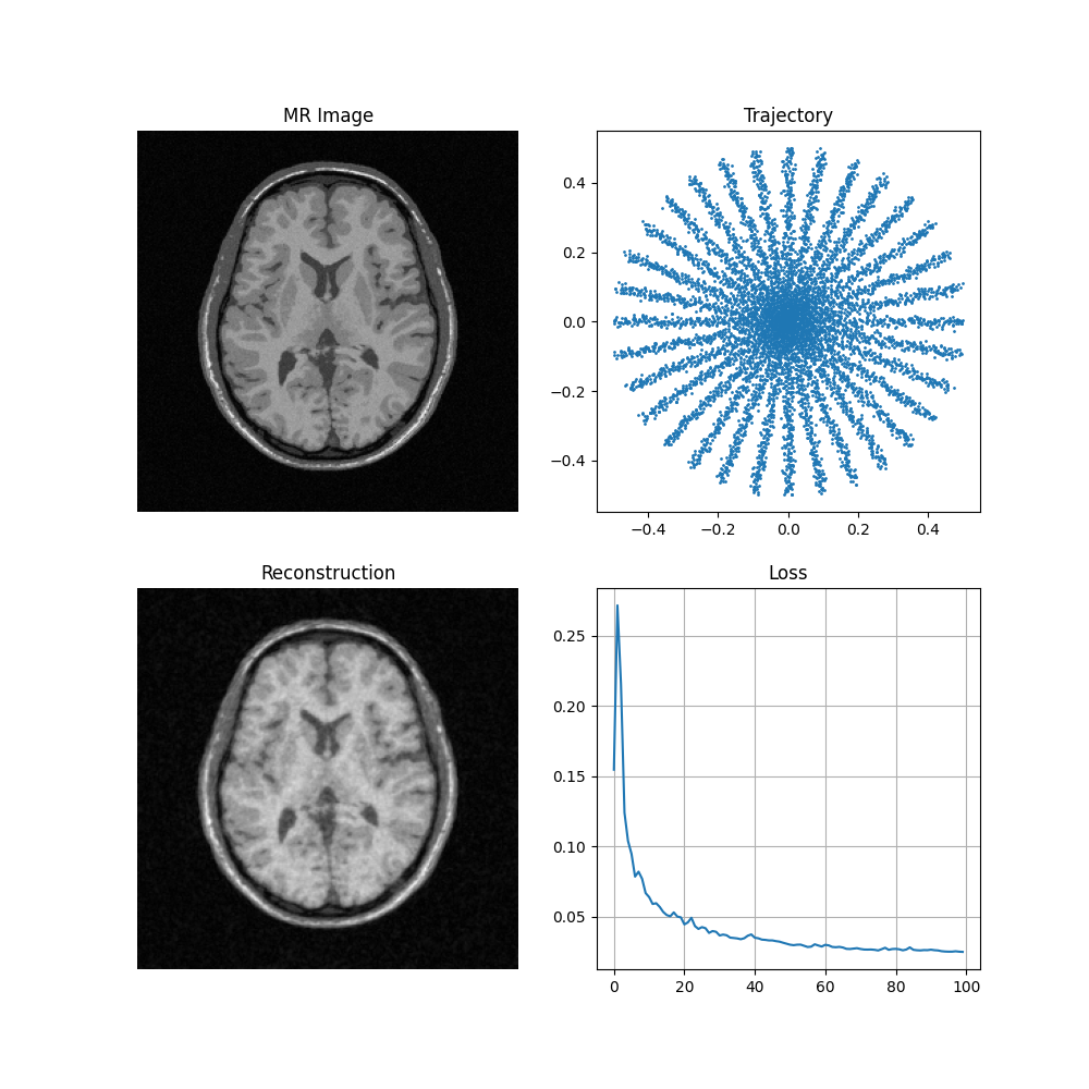 MR Image, Trajectory, Reconstruction, Loss