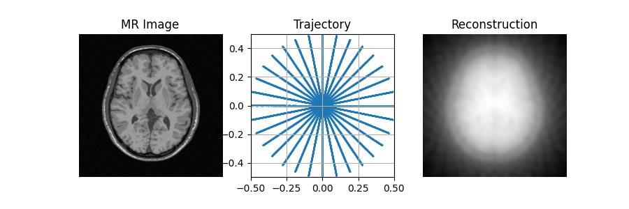 MR Image, Trajectory, Reconstruction