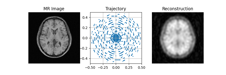 MR Image, Trajectory, Reconstruction