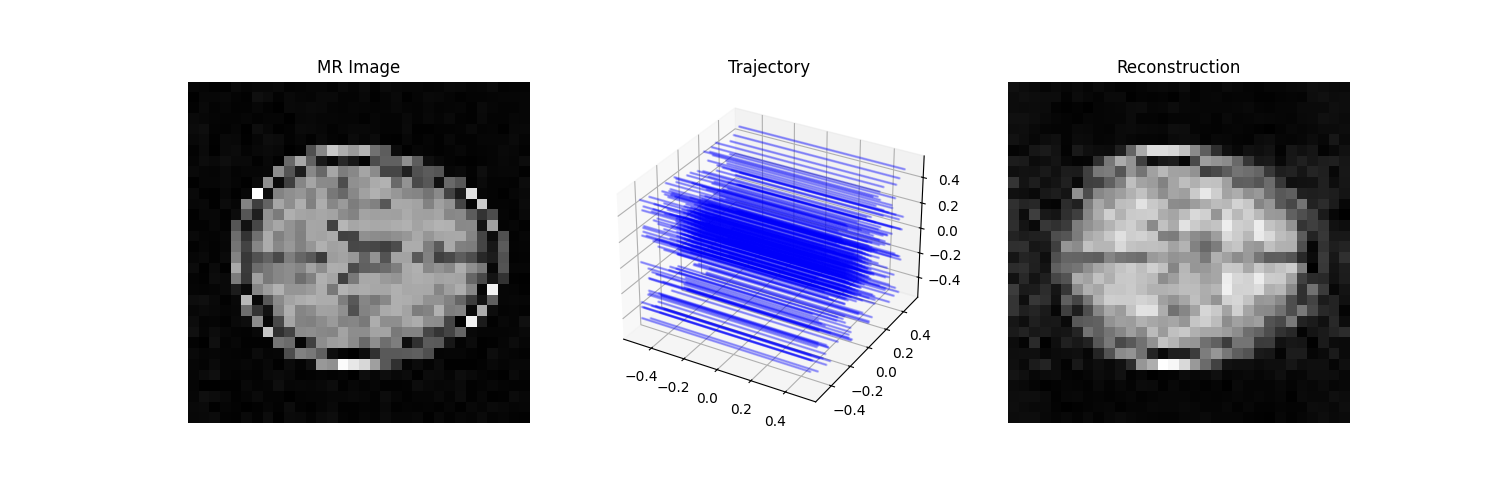 MR Image, Reconstruction, Trajectory