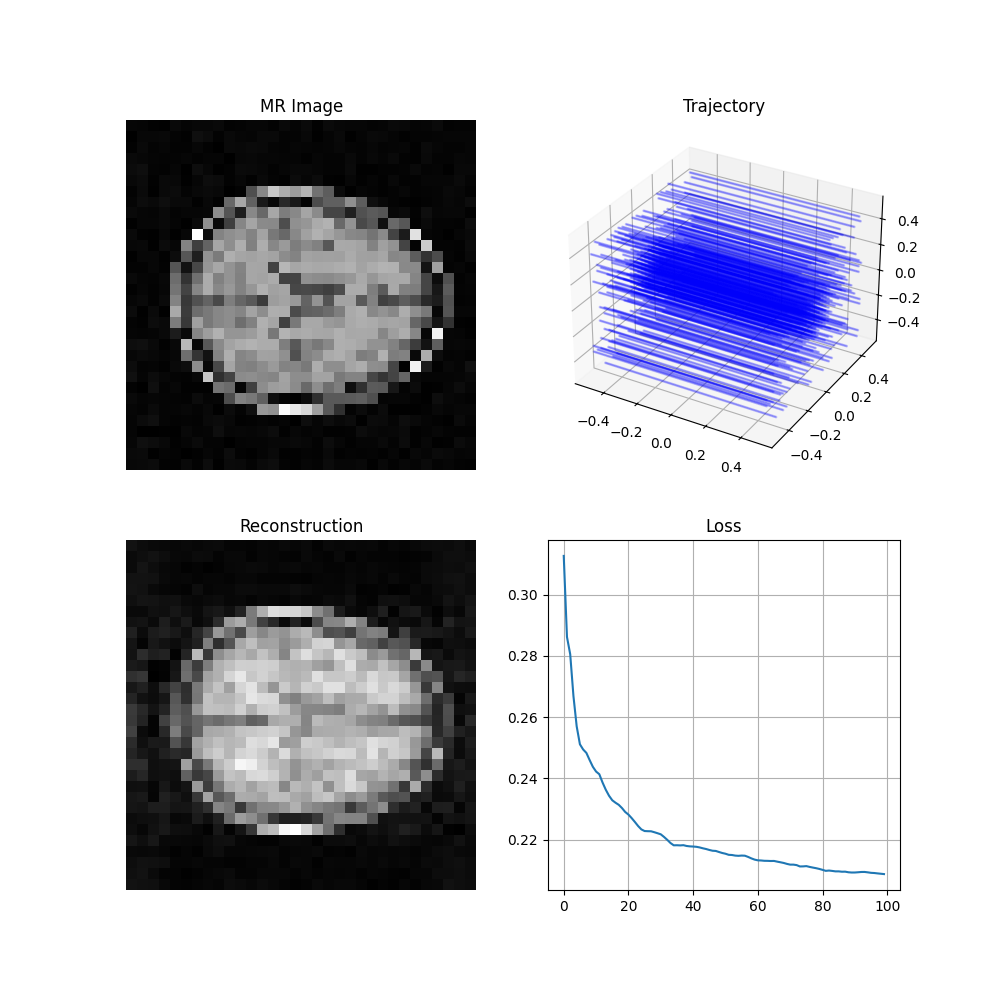 MR Image, Reconstruction, Loss, Trajectory