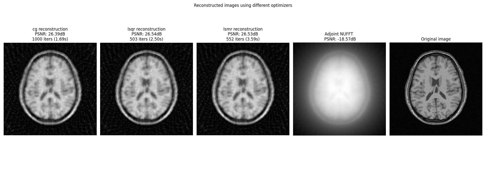 Reconstructed images using different optimizers, cg reconstruction  PSNR: 26.39dB  1000 iters (1.69s), lsqr reconstruction  PSNR: 26.54dB  503 iters (2.50s), lsmr reconstruction  PSNR: 26.53dB  552 iters (3.59s), Adjoint NUFFT   PSNR: -18.57dB, Original image