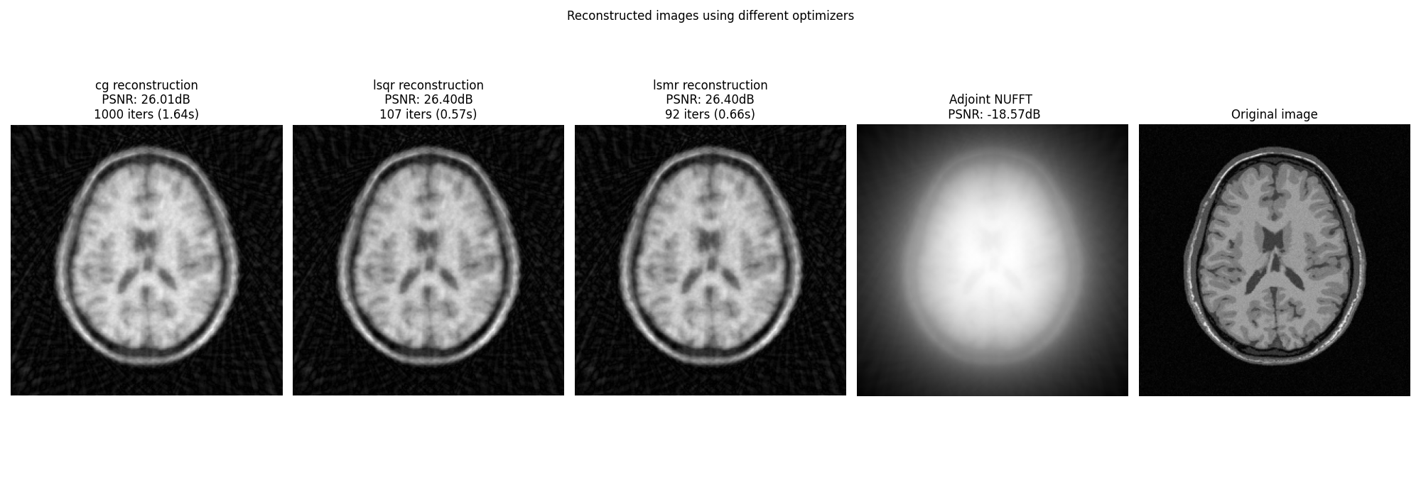 Reconstructed images using different optimizers, cg reconstruction  PSNR: 26.01dB  1000 iters (1.64s), lsqr reconstruction  PSNR: 26.40dB  107 iters (0.57s), lsmr reconstruction  PSNR: 26.40dB  92 iters (0.66s), Adjoint NUFFT   PSNR: -18.57dB, Original image