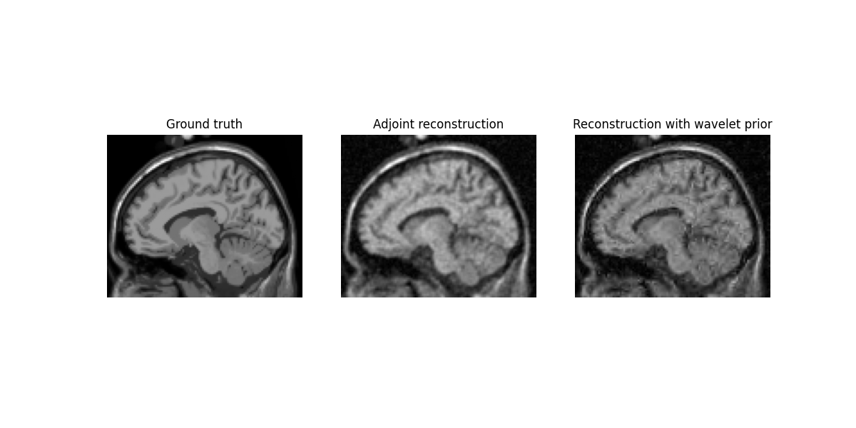 Ground truth, Adjoint reconstruction, Reconstruction with wavelet prior