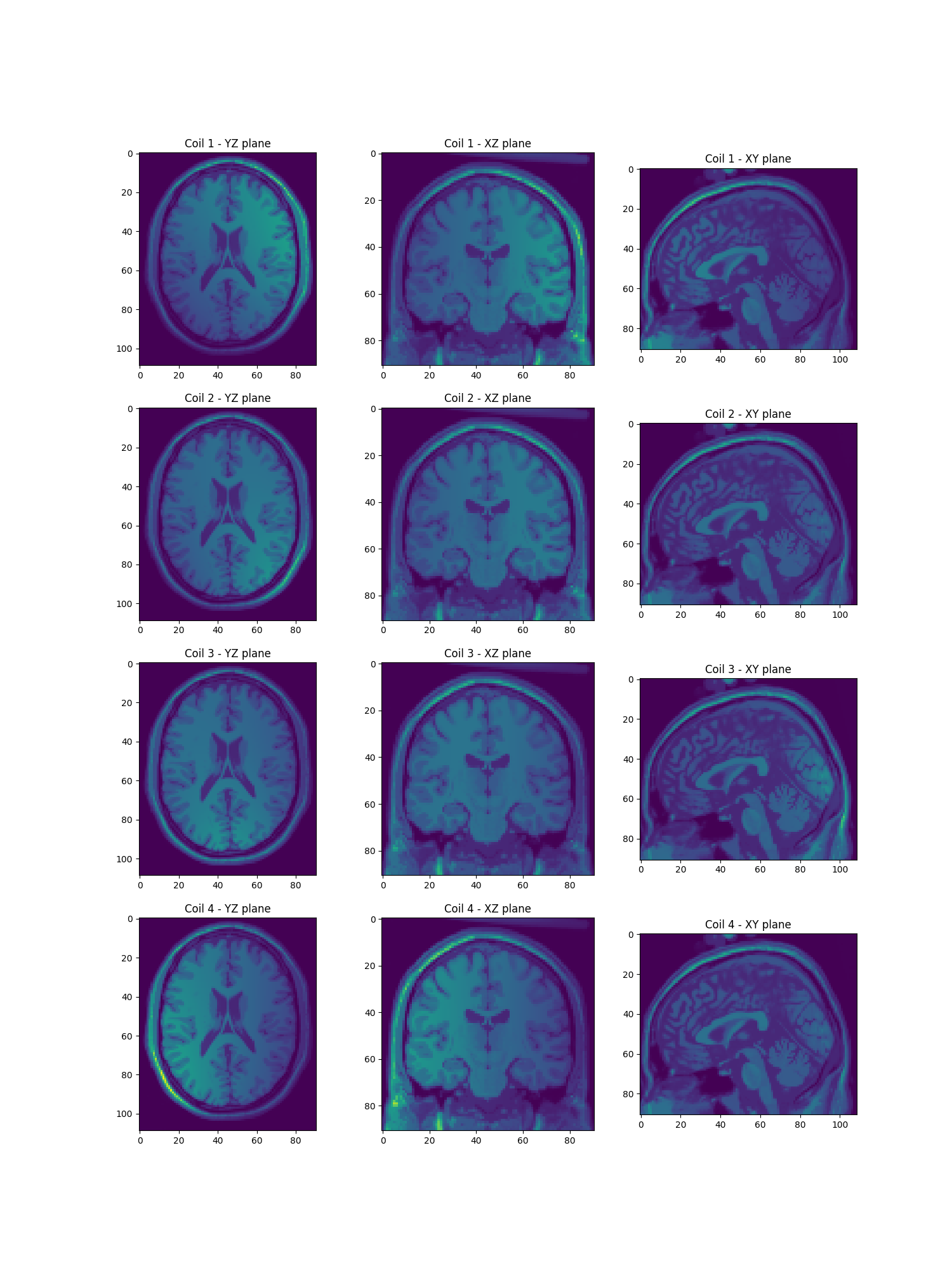 Coil 1 - YZ plane, Coil 1 - XZ plane, Coil 1 - XY plane, Coil 2 - YZ plane, Coil 2 - XZ plane, Coil 2 - XY plane, Coil 3 - YZ plane, Coil 3 - XZ plane, Coil 3 - XY plane, Coil 4 - YZ plane, Coil 4 - XZ plane, Coil 4 - XY plane