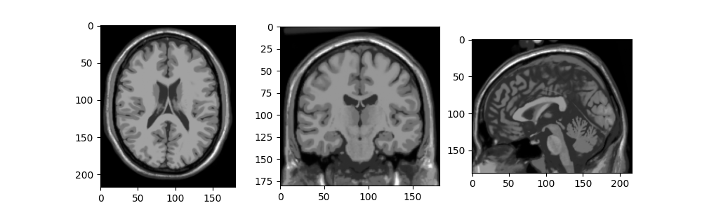 example stacked