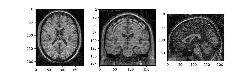 example stacked